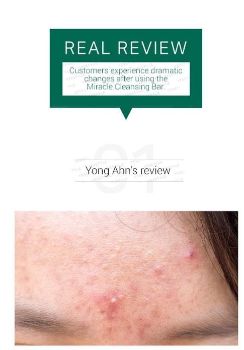 SOME BY MI - AHA, BHA, PHA 30 Days Miracle Cleansing Bar 1pc, 106g, 115 g, 8809408260793