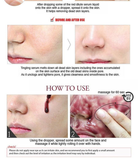 so natural - Red Peel Tingle Serum, 35ml, 108 g, 8809263875606