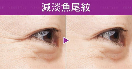 Zino - Anti-Age Eye Firm Filler Cream, 12g, 38 g, 4895084328197