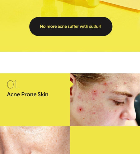 By Wishtrend - Sulfur 3% Clean Gel, 30g, 48 g, 8809572890642