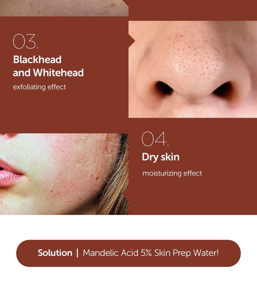 By Wishtrend - Mandelic Acid 5% Skin Prep Water MINI, 30ml, 58 g, 8809572890611