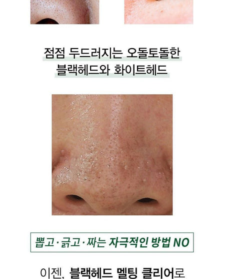 NATUREKIND - Blackhead Melting Clear, 55ml, 93 g, 8809665912503