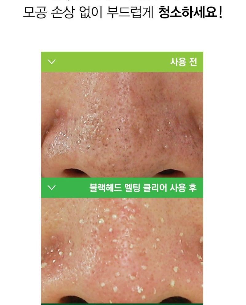 NATUREKIND - Blackhead Melting Clear, 55ml, 93 g, 8809665912503