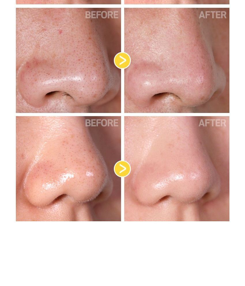TIA’M - Blackhead Out Sheet, 35 sheets, 152 g, 8809367897009