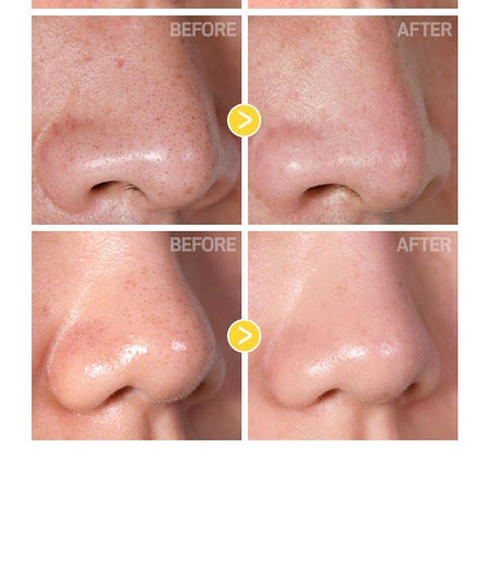 TIA’M - Blackhead Out Sheet, 35 sheets, 152 g, 8809367897009
