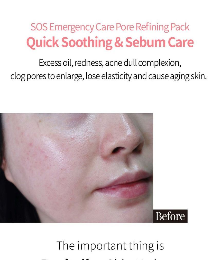 Aperire - Spa Relief Very Pretty Pore Mask, 120g, 167 g, 8805533133018