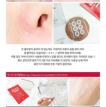 RiRe - Red Spot Micro Needle Patch, 6 patches, 13 g, 8809410283889