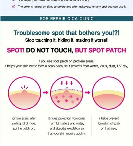 TOSOWOONG - SOS Repair Cica Clinic Acne Patch 66pcs, 1 pack x 66pcs, 20 g, 8809179102995