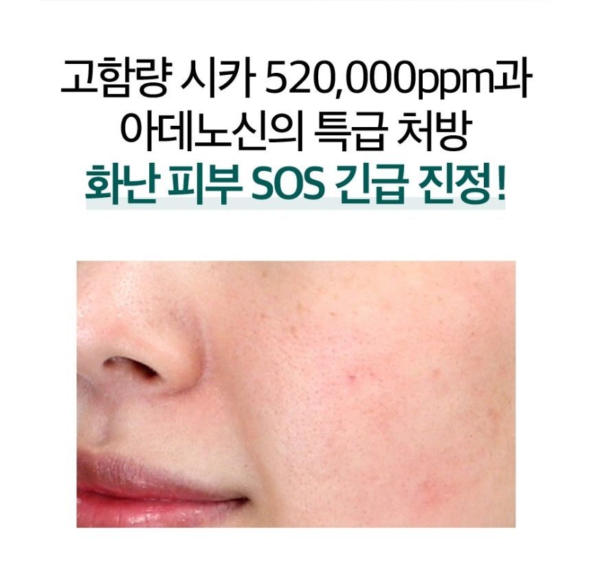 TOSOWOONG - Adenosine Cica Cream, 100ml, 250 g, 8809179107037