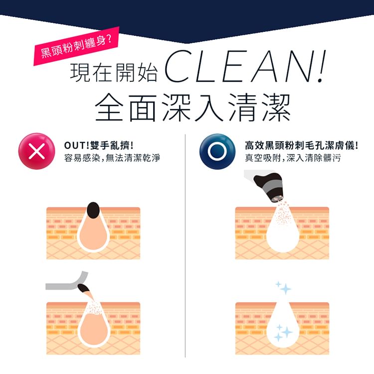 My Scheming - Blackhead Remove Vacuum Cleaner, 1 pc, 197 g, 4713410992594
