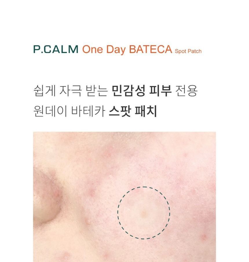 P.CALM - One Day BATECA Spot Patch, 36 patches, 14 g, 8809884830022