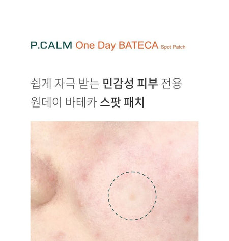 P.CALM - One Day BATECA Spot Patch, 36 patches, 14 g, 8809884830022