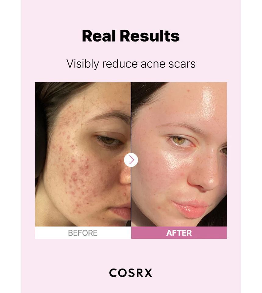 COSRX - The Niacinamide 15 Serum, 20ml, 134 g, 8809598454637