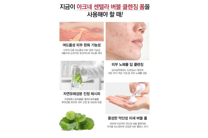 TOSOWOONG - Acne Centella Bubble Cleansing Foam, 150g, 380 g, 8809179106825