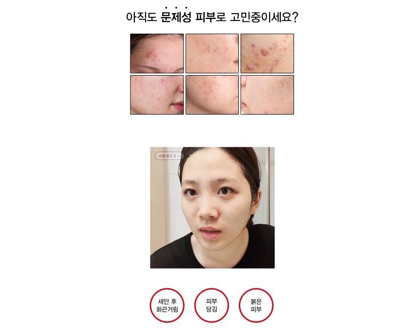 TOSOWOONG - Acne Centella Bubble Cleansing Foam, 150g, 380 g, 8809179106825