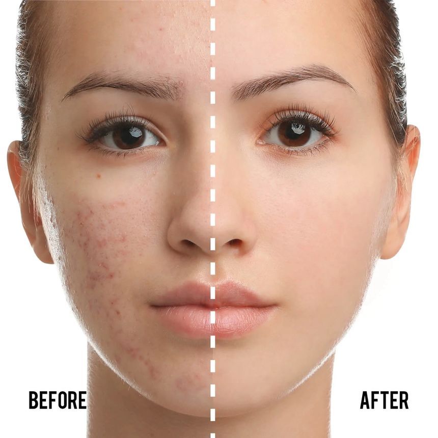 CATKIN - Summer Palace BB Moisture Cover BB Cream Cushion Foundation Set (#C01 Natural), #C01 Natural, 170 g, 6974678272578