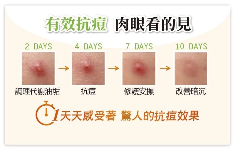 UNICAT - Acne Go Away Pimple Fighting Gel, 15ml, 33 g, 4715862363687
