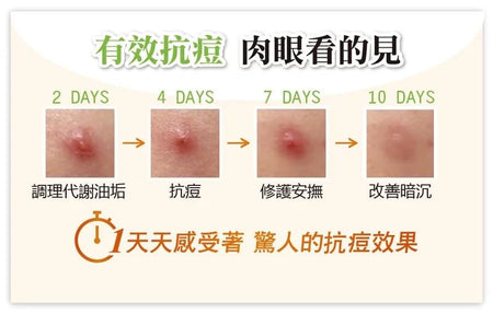 UNICAT - Acne Go Away Pimple Fighting Gel, 15ml, 33 g, 4715862363687