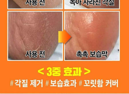 SUNGBOON EDITOR - LHA Baby Foot Scrub Stick, 20g, 72 g, 8809684561812