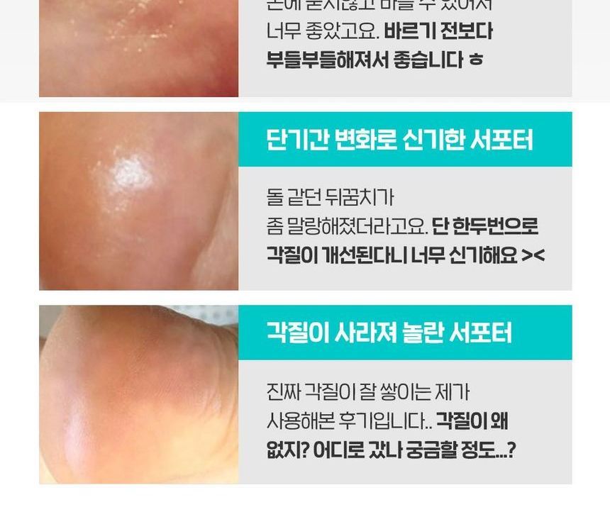 SUNGBOON EDITOR - LHA Baby Foot Scrub Stick, 20g, 72 g, 8809684561812