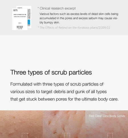medicube - Red Clear Cica Body Scrub, 270g, 320 g, 8809852976769