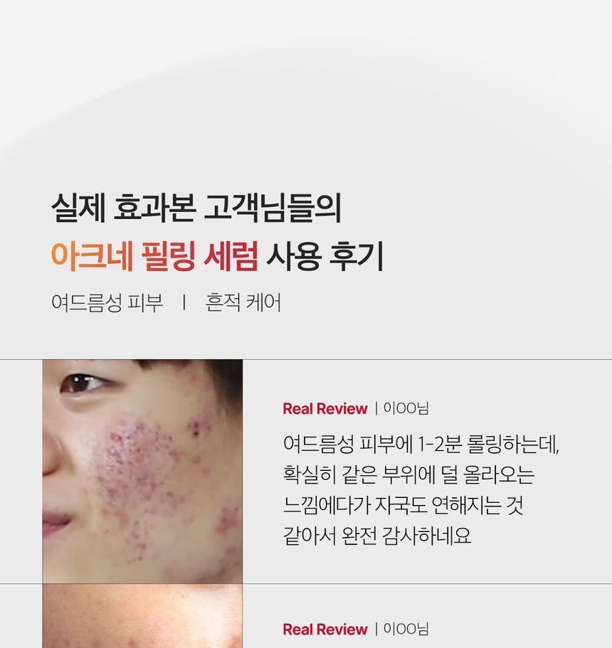 medicube - Red Acne Succinic Acid Peel, 40g, 120 g, 8809517419709