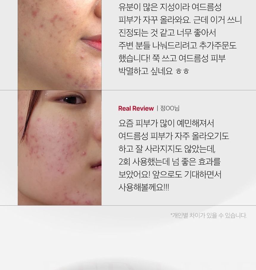 medicube - Red Acne Succinic Acid Peel, 40g, 120 g, 8809517419709