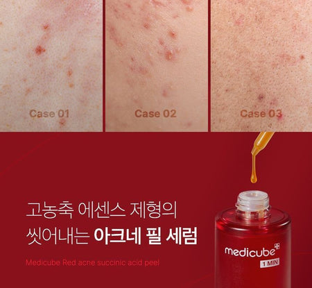 medicube - Red Acne Succinic Acid Peel, 40g, 120 g, 8809517419709