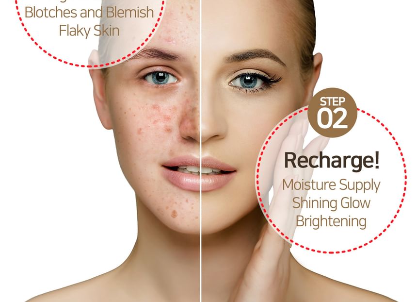 SOME BY MI - Galactomyces Pure Vitamin C Glow Serum, 2024 Version - 30ml, 100 g, 8809647390114