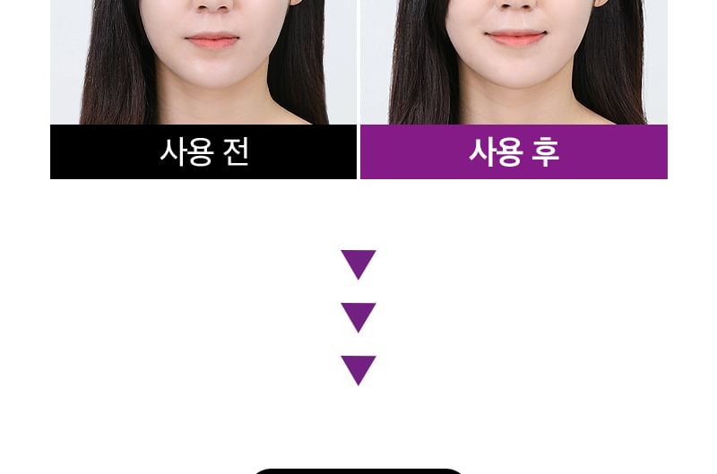 TOSOWOONG - SOS Intensive Magic Clinic Anti-Wrinkle Patch, 10 patches x 5 pcs, 73 g, 8809179107426
