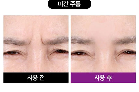 TOSOWOONG - SOS Intensive Magic Clinic Anti-Wrinkle Patch, 10 patches x 5 pcs, 73 g, 8809179107426