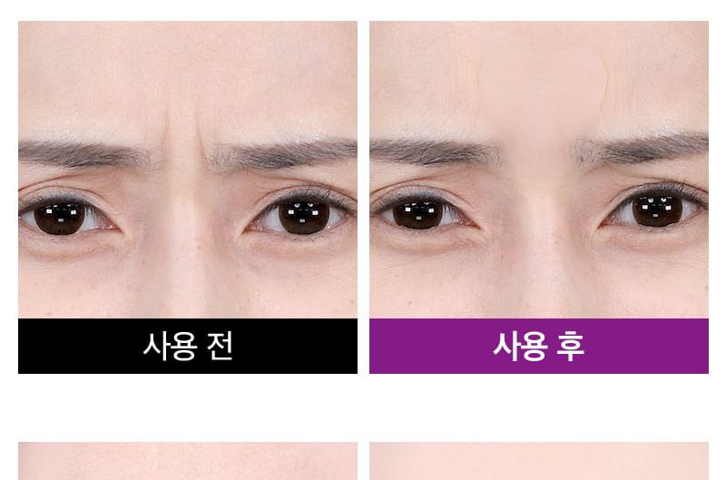 TOSOWOONG - SOS Intensive Magic Clinic Anti-Wrinkle Patch, 10 patches x 5 pcs, 73 g, 8809179107426