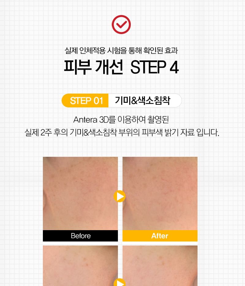 TOSOWOONG - 8 Days Spot Cream, 50g, 130 g, 8809179107174