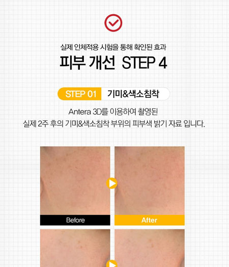 TOSOWOONG - 8 Days Spot Cream, 50g, 130 g, 8809179107174