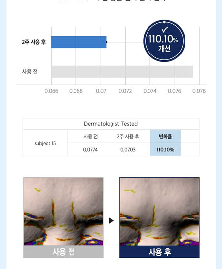 MONSTER FACTORY - Spot Tok Wrinkle Patch, 50 patches, 50 g, 8809665918017