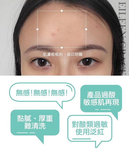 EILEEN GRACE - Conditioning Acne Serum, 30ml, 180 g, 4717002590113