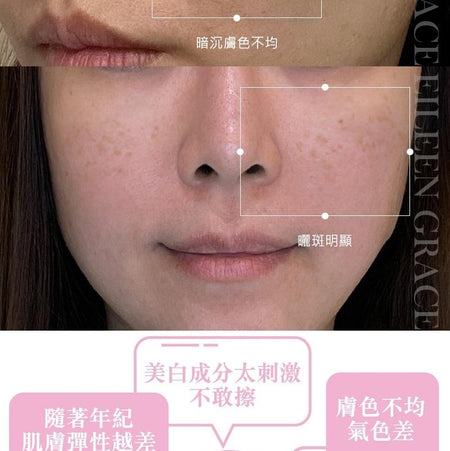 EILEEN GRACE - L-Ascorbic Acid Serum, 30ml, 180 g, 4717002590137