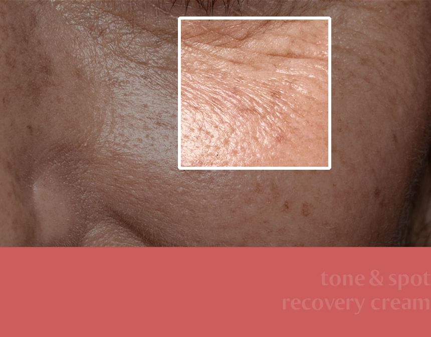 FULLight - Re:dence Tone & Spot Recovery Cream, 50ml, 130 g, 8809859770261