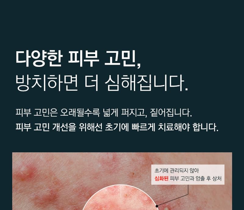 TOSOWOONG - SOS Repair Cica Clinic Madecare Oint., 50g, 79 g, 8809179106542