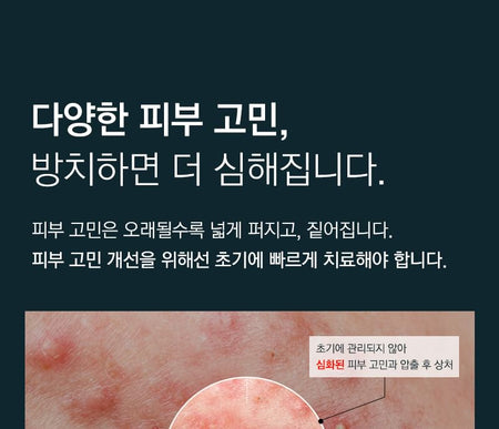 TOSOWOONG - SOS Repair Cica Clinic Madecare Oint., 50g, 79 g, 8809179106542