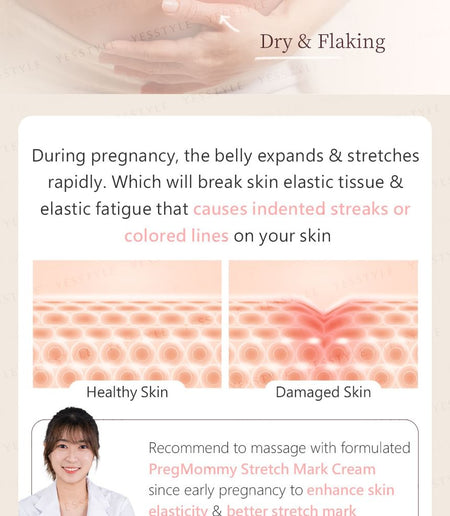 BHK’s - Preg Mommy Stretch Mark Cream, 180ml, 250 g, 4713051524918