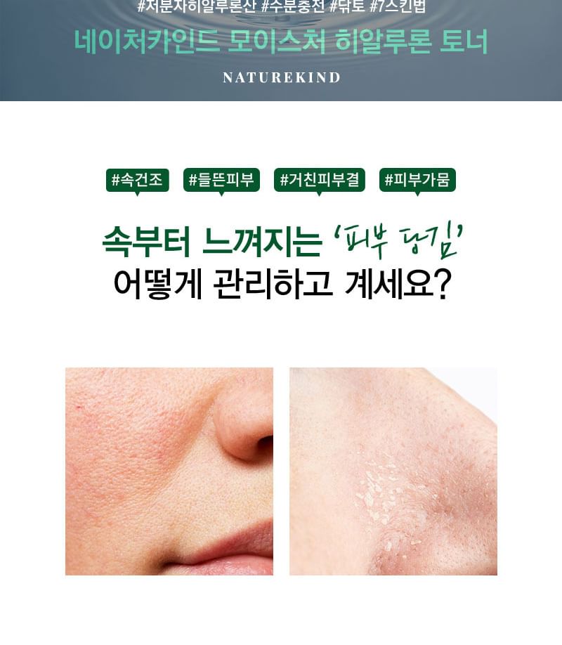 NATUREKIND - Natural Moisture Hyaluron Toner, 520ml, 1000 g, 8809665912350