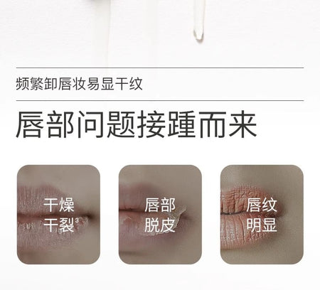 WATERCOME - Soothing Anti-Wrinkle Lip Balm, 1pc - 3g, 19 g, 6973625650223