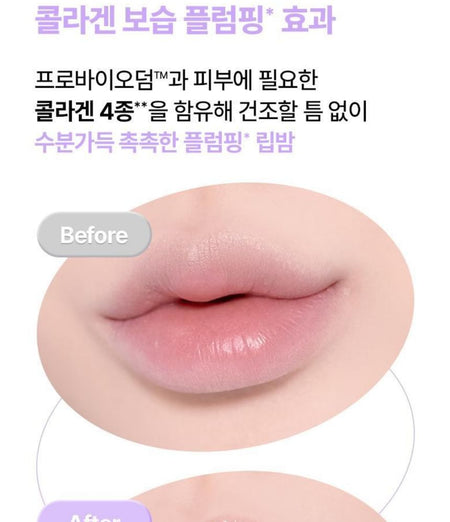 BIOHEAL BOH - Probioderm Collagen Volume Lip Balm, 15ml, 54 g, 8809971483520