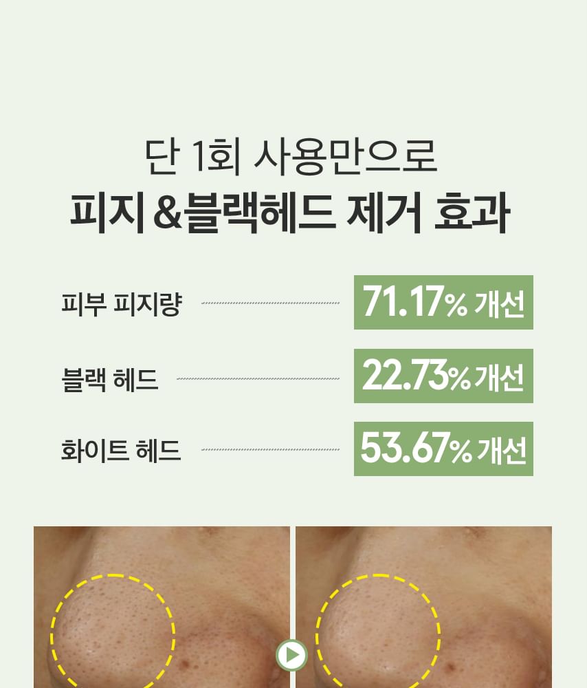 ONE THING - Witch Hazel Blackhead Cleaner, 100ml, 137 g, 8809704191302