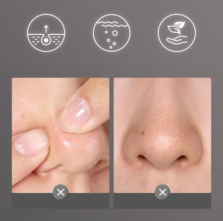 JULIA POP - Blackhead Clear Mud Stick, 1pc - 7g, 40 g, 6951286442845