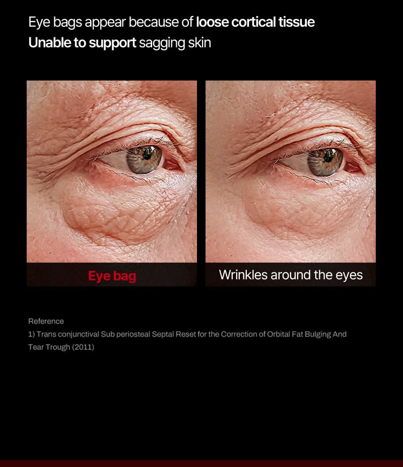 Meditherapy - Wrinkle-Fit Tangle Eye Cream, 20ml, 69 g, 8809606773439