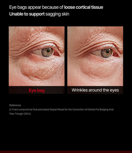 Meditherapy - Wrinkle-Fit Tangle Eye Cream, 20ml, 69 g, 8809606773439