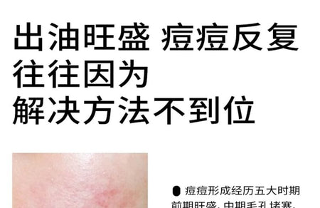 PMPM - Sea Fennel Five-dimensional Inhibit Acne Care Essence, 15ml, 65 g, 6975612840822