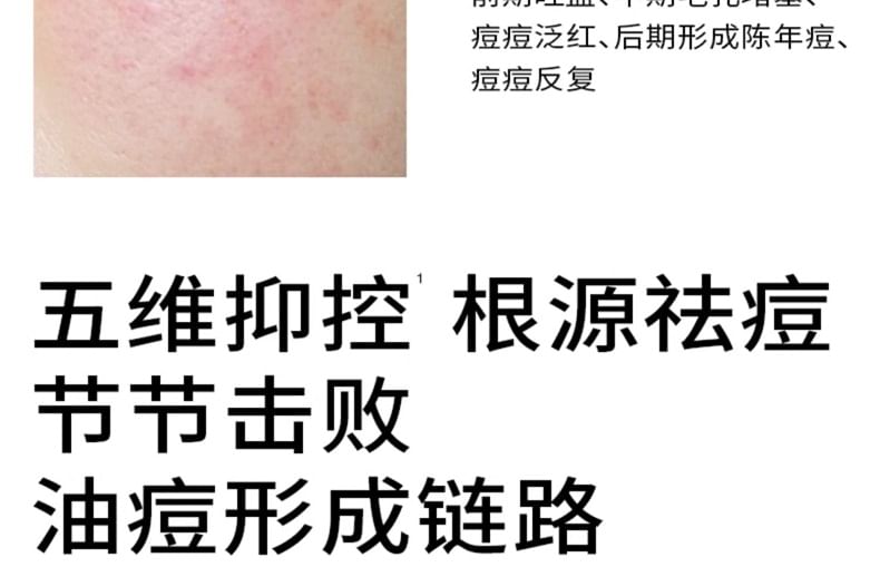 PMPM - Sea Fennel Five-dimensional Inhibit Acne Care Essence, 15ml, 65 g, 6975612840822